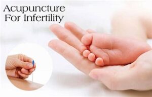 How Often Should I Get Acupuncture Sessions While Undergoing IVF?