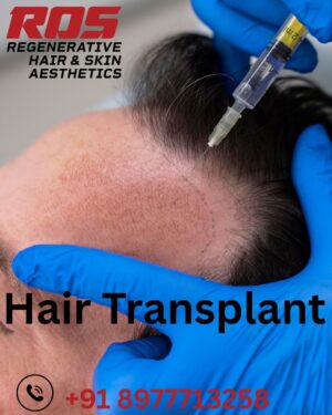 Harnessing Stem Cell Technology: A Breakthrough in Hair Loss and Regrowth Treatments