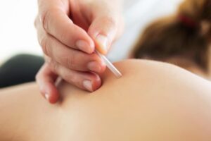 How Trigger Point Injections Provide Fast Relief for Muscle Pain