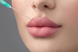 Importance of Selecting the Best Plastic Surgeon in Dubai for Russian Lip Fillers