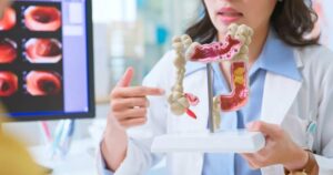 Comprehensive Guide to Colon Cancer Treatment in Singapore