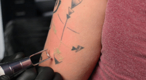 Laser tattoo removal
