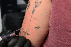 Laser tattoo removal