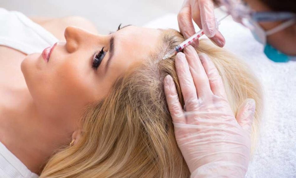 Best PRP Hair Treatment in Dubai