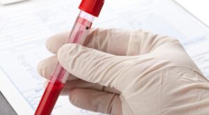 Blood Test at Home in Dubai: How Results Are Delivered