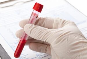 Blood Test at Home in Dubai: How Results Are Delivered