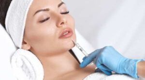 Lip Fillers