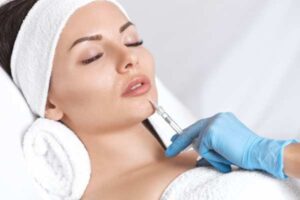 Lip Fillers