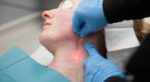 Endolift in Dubai