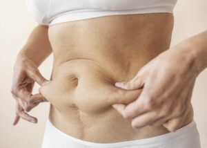 Best Liposuction Surgeon in Dubai