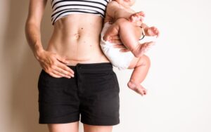Bouncing Back: Your Guide to Post-Pregnancy Recovery