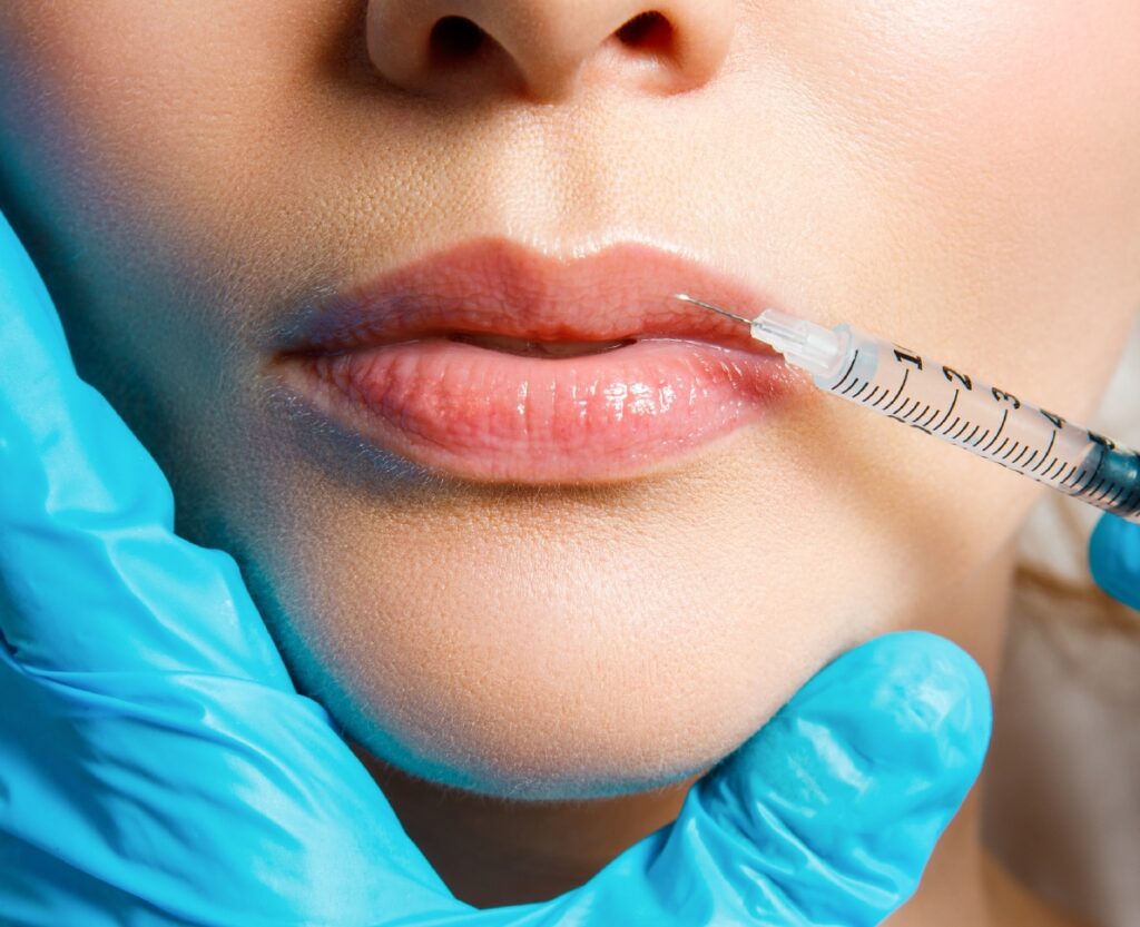 Juvederm Fillers in Dubai