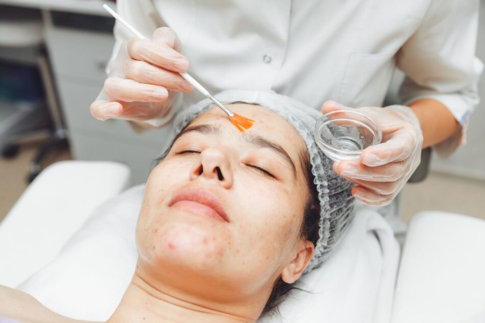 Cold Peel in Dubai