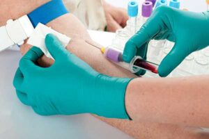 How to Interpret Your Blood Test at Home in Dubai Results