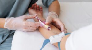 IV in Dubai for Stress & Anxiety Relief