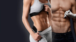 vaser 4D liposuction in dubai