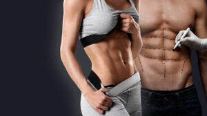 vaser 4D liposuction in dubai
