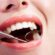 Tooth Filling Cost in Dubai