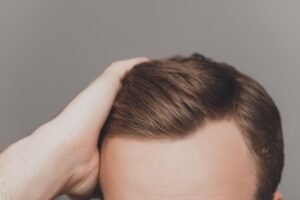 Front Line Hair Fixing in Dubai