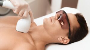 Male Laser Hair Removal Cost in Dubai