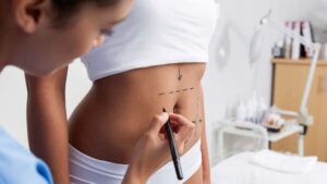 Struggling With Loose Skin? Learn How Tummy Tuck Can Help