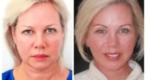 Best Plastic Surgeon in dubai