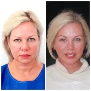 Best Plastic Surgeon in dubai