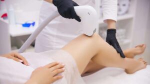 Why Best Laser Hair Removal Is the Secret to Smooth Skin