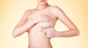 Preparing Emotionally and Physically: Advice from the Best Breast Augmentation Surgeons in Dubai