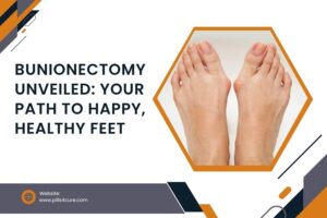 Bunionectomy: Your Guide to Pain-Free Feet in 2025