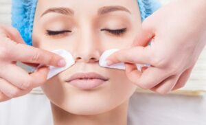Chemical Peels Can Revitalize Tired-Looking Skin