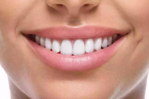 Do Premium Results Justify the High Teeth Whitening Cost Today?