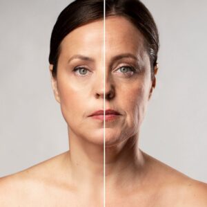 Do Hormonal Changes Affect How Anti-Aging Treatments Work in Dubai?