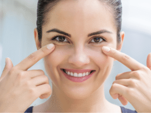 How Do I Avoid the ‘Tyndall Effect’ with Under Eye Fillers?