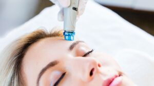 How HydraFacial Works: A Step-by-Step Breakdown