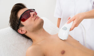 Laser Hair Removal for Men in Dubai: Confidence Meets Convenience
