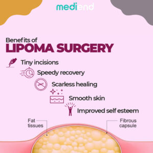 how do I know if my lipoma surgery is healing properly?