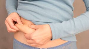 Liposuction Surgeons in Dubai