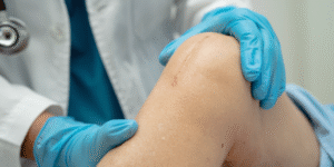 How to improve recovery in 6 weeks? Important things after knee Replacement surgery – Know from Orthopedic Surgeon in Ghaziabad