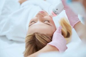 Scar Laser Treatment A Game Changer for Skin