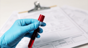 AI-Powered Blood Test at Home in Dubai – Precision Testing