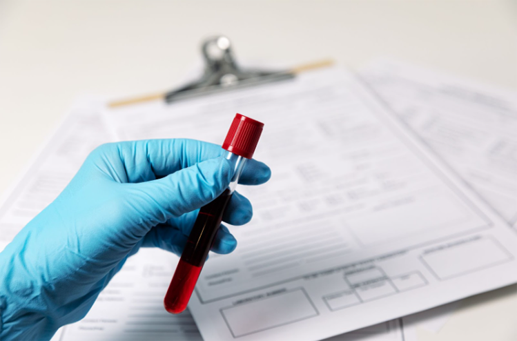 AI-Powered Blood Test at Home in Dubai – Precision Testing