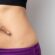 Stretch Marks Removal: Tips for Lasting Results