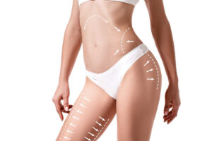 Top 10 Benefits of Choosing Body Jet Liposuction Over Traditional Liposuction