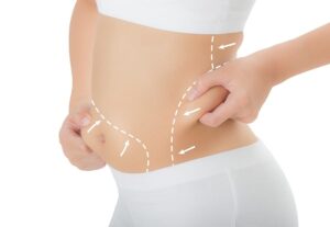 10 Myths About Mini Abdominoplasty in Dubai – Debunked