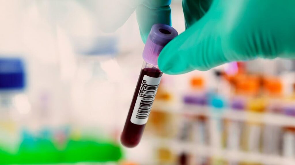 Hepatitis C Test in Dubai