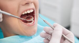Tooth Filling Cost in Dubai