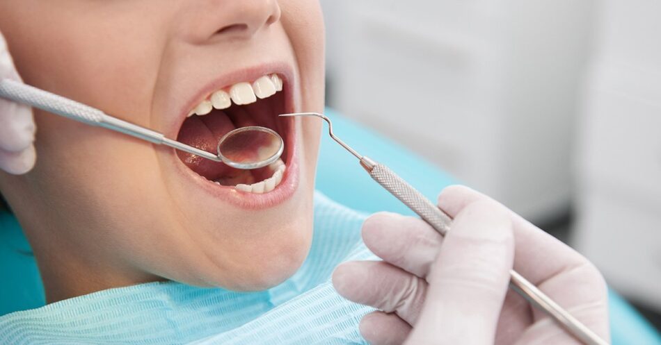 Tooth Filling Cost in Dubai