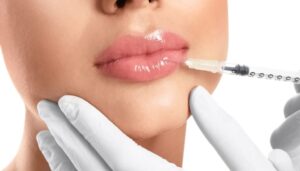 Best Lip Fillers Injections That Give You Smooth and Full Lips