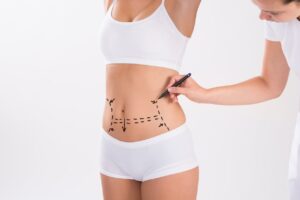 Liposuction in Dubai: Combining Liposuction with Other Cosmetic Procedures for Enhanced Results